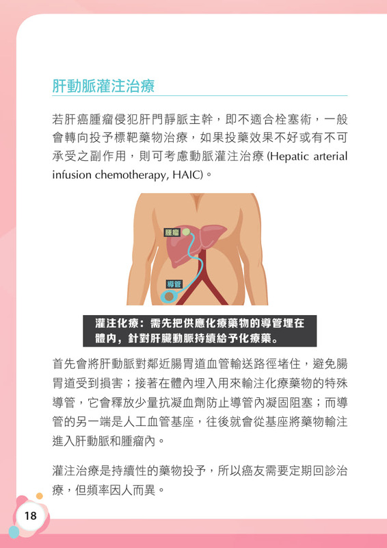 肝癌 衛教手冊圖片